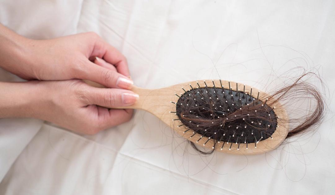 تساقط الشعر – الأسباب وأفضل طرق العلاج للرجال والنساء